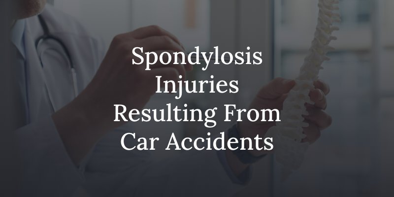 Spondylosis injuries and car accidents