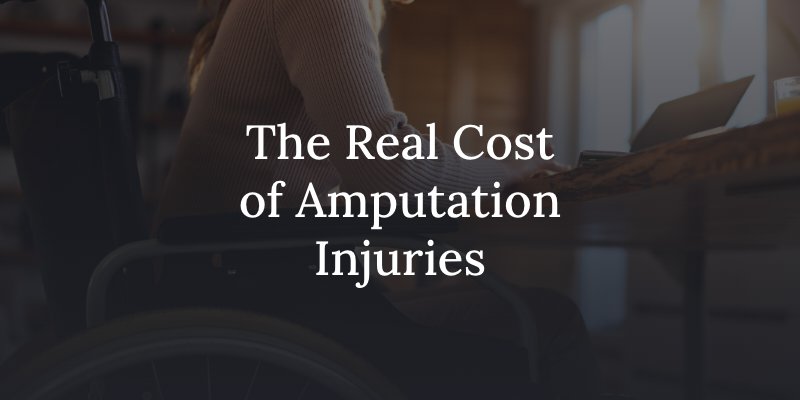 factoring in the real cost of amputation injuries in your personal injury claim